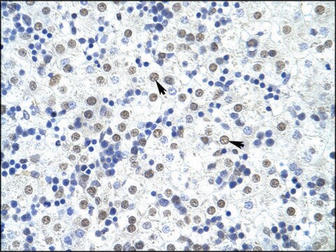 Anti-FOXP4 (AB1) antibody produced in rabbit IgG fraction of antiserum