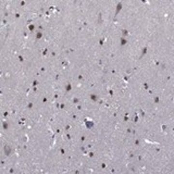 Anti-ETV5 antibody produced in rabbit Prestige Antibodies&#174; Powered by Atlas Antibodies, affinity isolated antibody, buffered aqueous glycerol solution