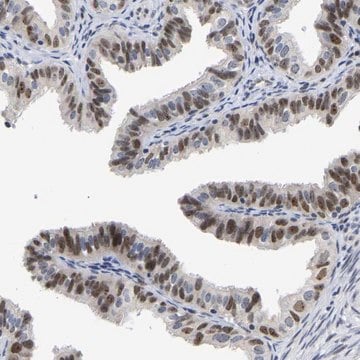 Anti-NLE1 antibody produced in rabbit Prestige Antibodies&#174; Powered by Atlas Antibodies, affinity isolated antibody, buffered aqueous glycerol solution