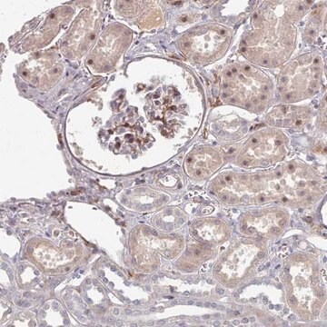 Anti-COL8A2 antibody produced in rabbit Prestige Antibodies&#174; Powered by Atlas Antibodies, affinity isolated antibody, buffered aqueous glycerol solution