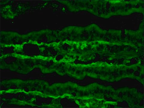 Monoclonal Anti-Tenascin antibody produced in rat clone MTn-12, ascites fluid