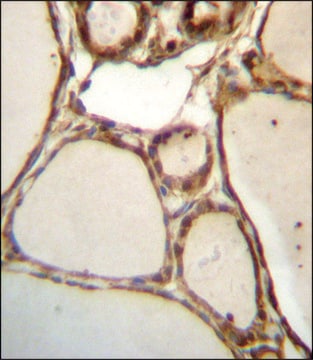 ANTI-HJURP (C-TERM) antibody produced in rabbit IgG fraction of antiserum, buffered aqueous solution