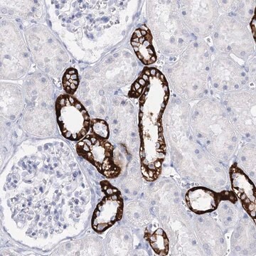 Anti-SLC17A2 antibody produced in rabbit Prestige Antibodies&#174; Powered by Atlas Antibodies, affinity isolated antibody, buffered aqueous glycerol solution