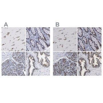 Anti-TMEM87A antibody produced in rabbit Prestige Antibodies&#174; Powered by Atlas Antibodies, affinity isolated antibody, buffered aqueous glycerol solution