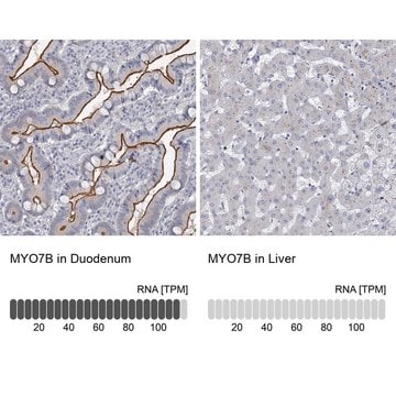 Anti-MYO7B antibody produced in rabbit Prestige Antibodies&#174; Powered by Atlas Antibodies, affinity isolated antibody, buffered aqueous glycerol solution