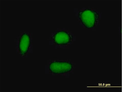 Anti-ELAC2 antibody produced in mouse purified immunoglobulin, buffered aqueous solution