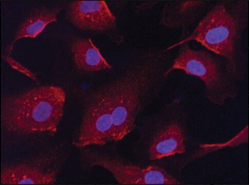 Anti-Anti-RanGAP1 (C-terminal) antibody produced in rabbit ~1&#160;mg/mL, affinity isolated antibody, buffered aqueous solution