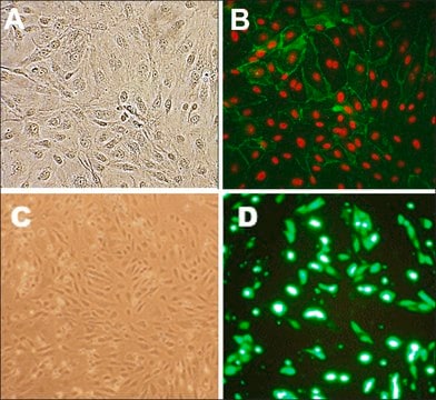 Human Lung Microvascular Endothelial Cells: HLMVEC, adult