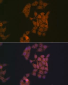 Anti-Kaiso/ZBTB33 Antibody, clone 10O4V2, Rabbit Monoclonal