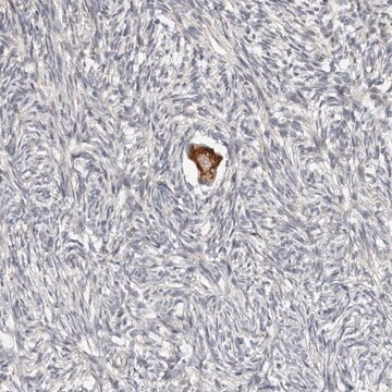 Anti-SMYD4 antibody produced in rabbit Prestige Antibodies&#174; Powered by Atlas Antibodies, affinity isolated antibody, buffered aqueous glycerol solution