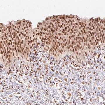 Anti-NFE2L1 antibody produced in rabbit Prestige Antibodies&#174; Powered by Atlas Antibodies, affinity isolated antibody, buffered aqueous glycerol solution