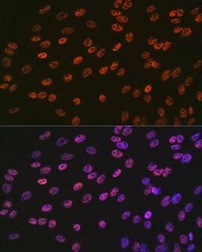 Anti-SMC1 antibody produced in rabbit