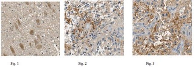 Anticuerpo anti-enolasa neuroespecífica from rabbit