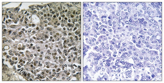 Anti-NFAT3 antibody produced in rabbit affinity isolated antibody