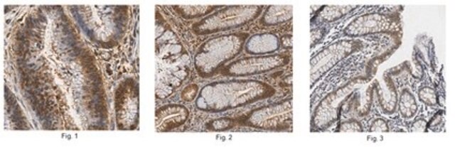 Anti-CIDEC Antibody/FSP27 0.5&#160;mg/mL, from rabbit