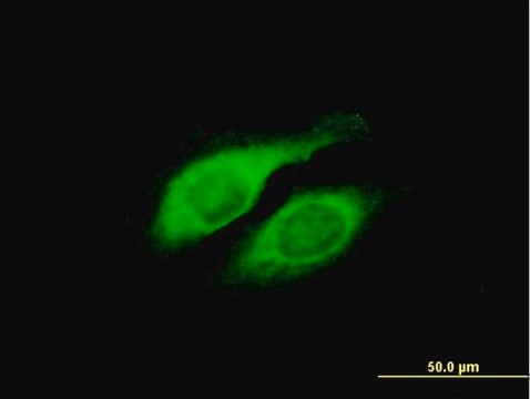 Anti-LYPLA2 antibody produced in mouse purified immunoglobulin, buffered aqueous solution