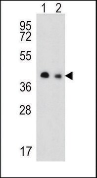 ANTI-SLC25A19 (C-TERM) antibody produced in rabbit IgG fraction of antiserum, buffered aqueous solution