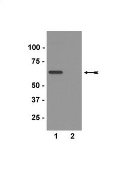 Anti-cleaved-Tau (Asp421) Antibody, clone C3 clone C3, Upstate&#174;, from mouse