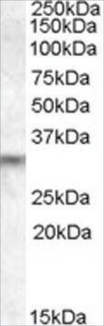 Anti-PRUNE2/BMCC1 antibody produced in goat affinity isolated antibody, buffered aqueous solution