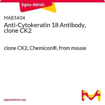 Anti-Cytokeratin 18 Antibody, clone CK2 clone CK2, Chemicon®, from ...