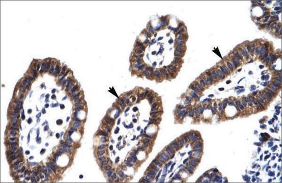 Anti-EGR2 antibody produced in rabbit affinity isolated antibody