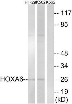 Anti-HOXA6 antibody produced in rabbit affinity isolated antibody