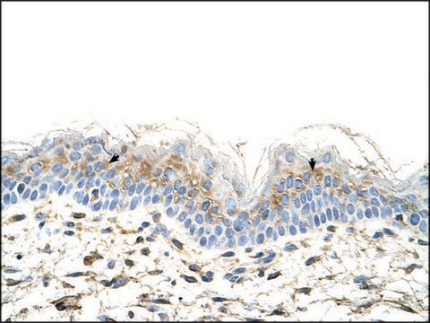 Anti-S100A3 antibody produced in rabbit IgG fraction of antiserum