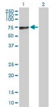 Anti-ALPP antibody produced in rabbit purified immunoglobulin, buffered aqueous solution