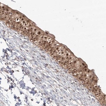 Anti-BROX antibody produced in rabbit Prestige Antibodies&#174; Powered by Atlas Antibodies, affinity isolated antibody, buffered aqueous glycerol solution