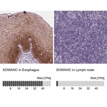 Anti-SOWAHC antibody produced in rabbit Prestige Antibodies&#174; Powered by Atlas Antibodies, affinity isolated antibody, buffered aqueous glycerol solution