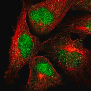 Anti-POLM antibody produced in rabbit Prestige Antibodies® Powered by ...