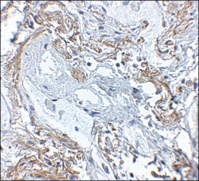 Anti-TNFAIP3 antibody produced in rabbit affinity isolated antibody, buffered aqueous solution, ab1