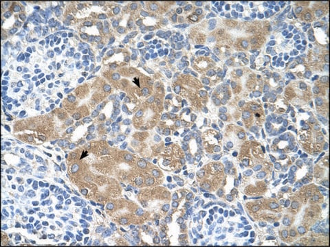 Anti-LMAN2 (AB1) antibody produced in rabbit affinity isolated antibody