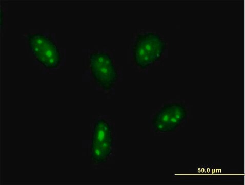 Anti-DDX24 antibody produced in mouse purified immunoglobulin, buffered aqueous solution