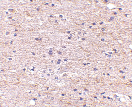 Anti-SATB2 (ab1) antibody produced in rabbit affinity isolated antibody, buffered aqueous solution