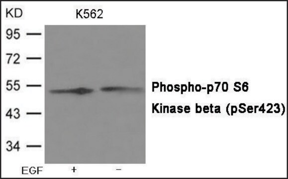 Anti-phospho-p70 S6 Kinase &#946; (pSer423) antibody produced in rabbit affinity isolated antibody