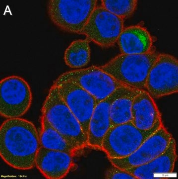 Anti-MMP-7 Antibody, clone 2B3 ZooMAb&#174; Rabbit Monoclonal recombinant, expressed in HEK 293 cells