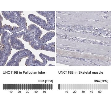 Anti-UNC119B antibody produced in rabbit Prestige Antibodies&#174; Powered by Atlas Antibodies, affinity isolated antibody, buffered aqueous glycerol solution