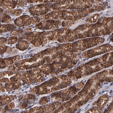 Anti-TIMM9 antibody produced in rabbit Prestige Antibodies&#174; Powered by Atlas Antibodies, affinity isolated antibody, buffered aqueous glycerol solution