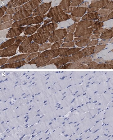 抗MYH1抗体 クローン1E15 ZooMAb® ウサギ・モノクローナル recombinant