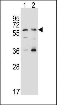 ANTI-SLC22A4 (C-TERM) antibody produced in rabbit IgG fraction of antiserum, buffered aqueous solution