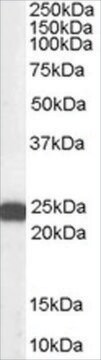 Anti-BAG2 antibody produced in goat affinity isolated antibody, buffered aqueous solution