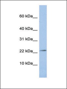 Anti-JAM3 antibody produced in rabbit affinity isolated antibody