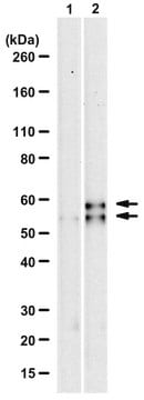 Anti-phospho-PPARgamma (Ser112) Antibody, clone AW504 rabbit monoclonal