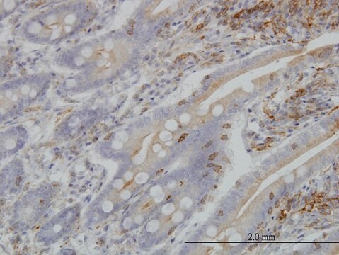 Monoclonal Anti-BFAR antibody produced in mouse clone 1C6, purified immunoglobulin, buffered aqueous solution