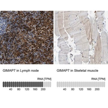 Anti-GIMAP7 antibody produced in rabbit Prestige Antibodies&#174; Powered by Atlas Antibodies, affinity isolated antibody, buffered aqueous glycerol solution, Ab1