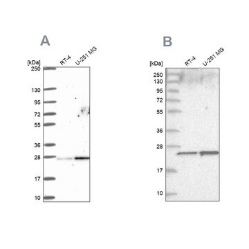 Anti-NOP16 antibody produced in rabbit Prestige Antibodies&#174; Powered by Atlas Antibodies, affinity isolated antibody