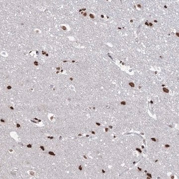 Anti-ABHD10 antibody produced in rabbit Prestige Antibodies&#174; Powered by Atlas Antibodies, affinity isolated antibody, buffered aqueous glycerol solution