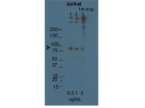 Anti-STIM1 Antibody Chemicon&#174;, from rabbit