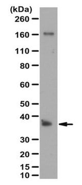 Anti-POU6F1 Antibody from rabbit, purified by affinity chromatography